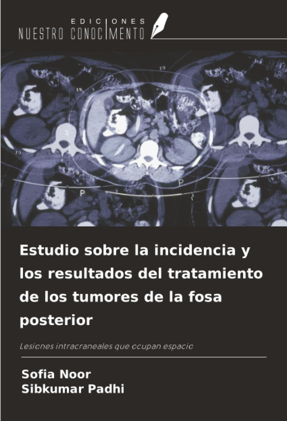 Estudio sobre la incidencia y los resultados del tratamiento de los tumores de la fosa posterior Medicine