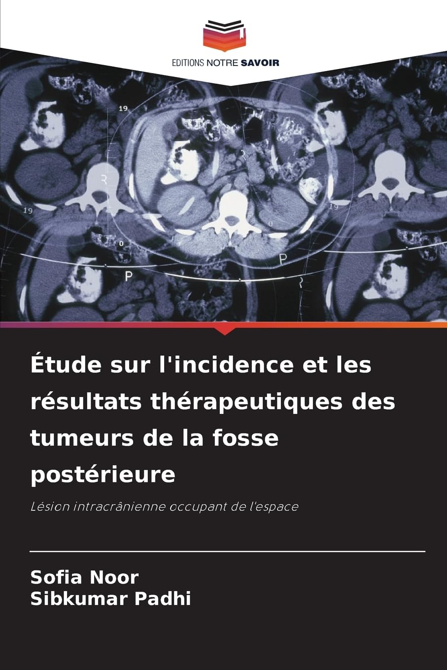 Étude sur l'incidence et les résultats thérapeutiques des tumeurs de la fosse postérieure Medicine