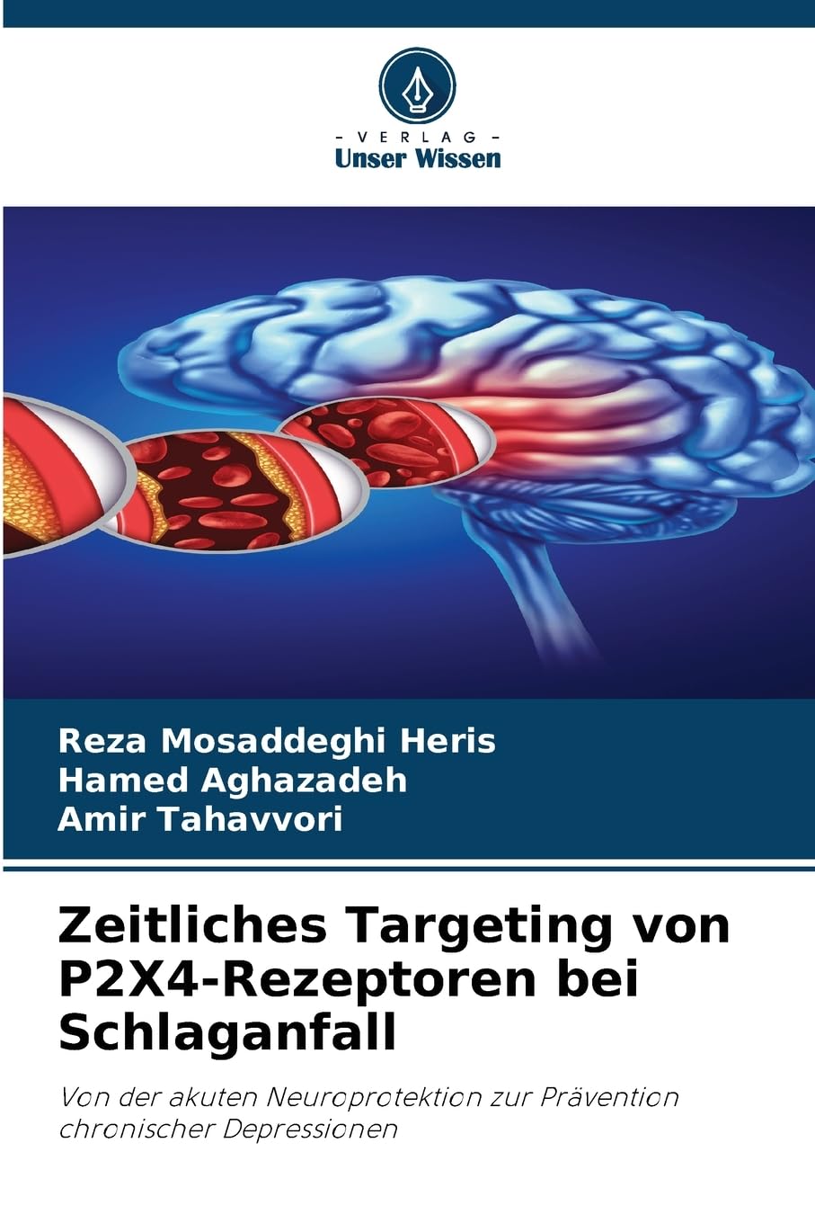 Zeitliches Targeting von P2X4-Rezeptoren bei Schlaganfall Medicine