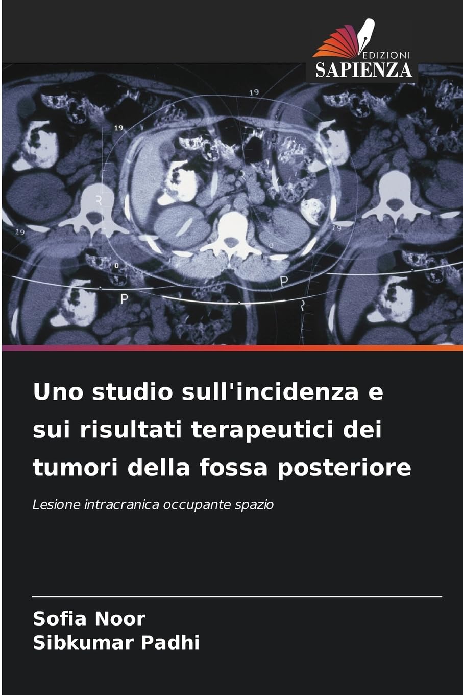 Uno studio sull'incidenza e sui risultati terapeutici dei tumori della fossa posteriore Medicine