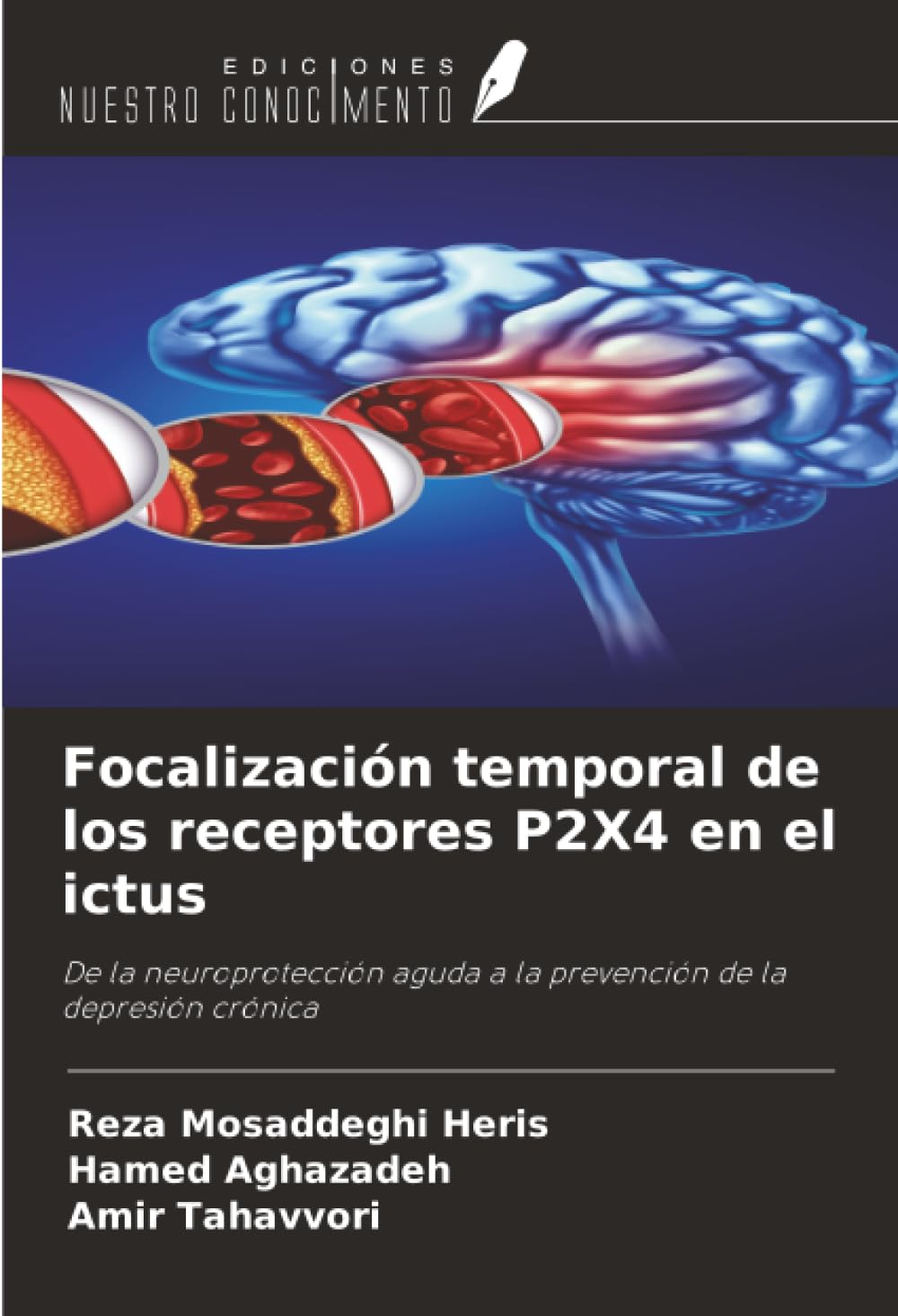 Focalización temporal de los receptores P2X4 en el ictus Medicine