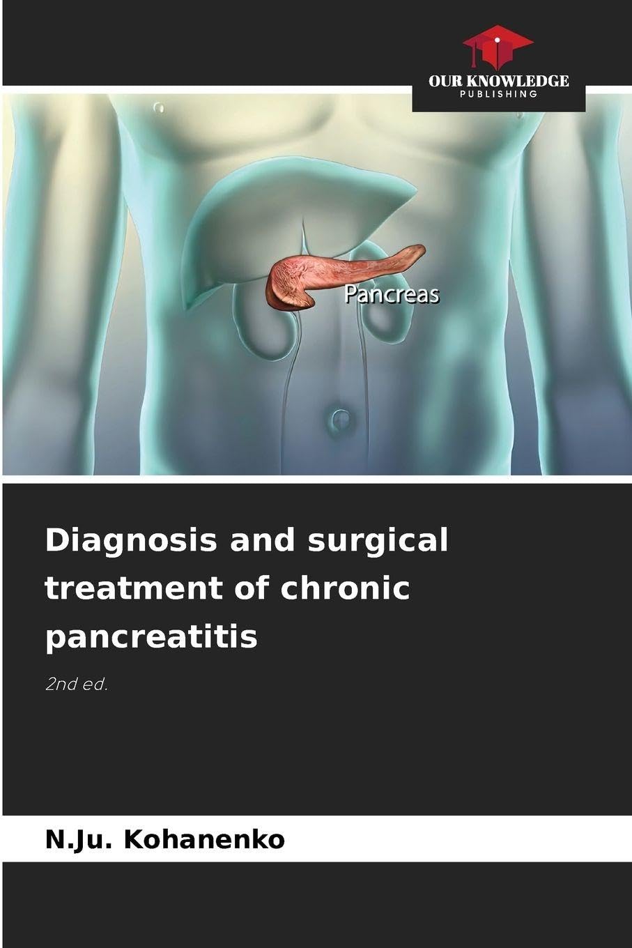 Diagnosis and surgical treatment of chronic pancreatitis Medicine
