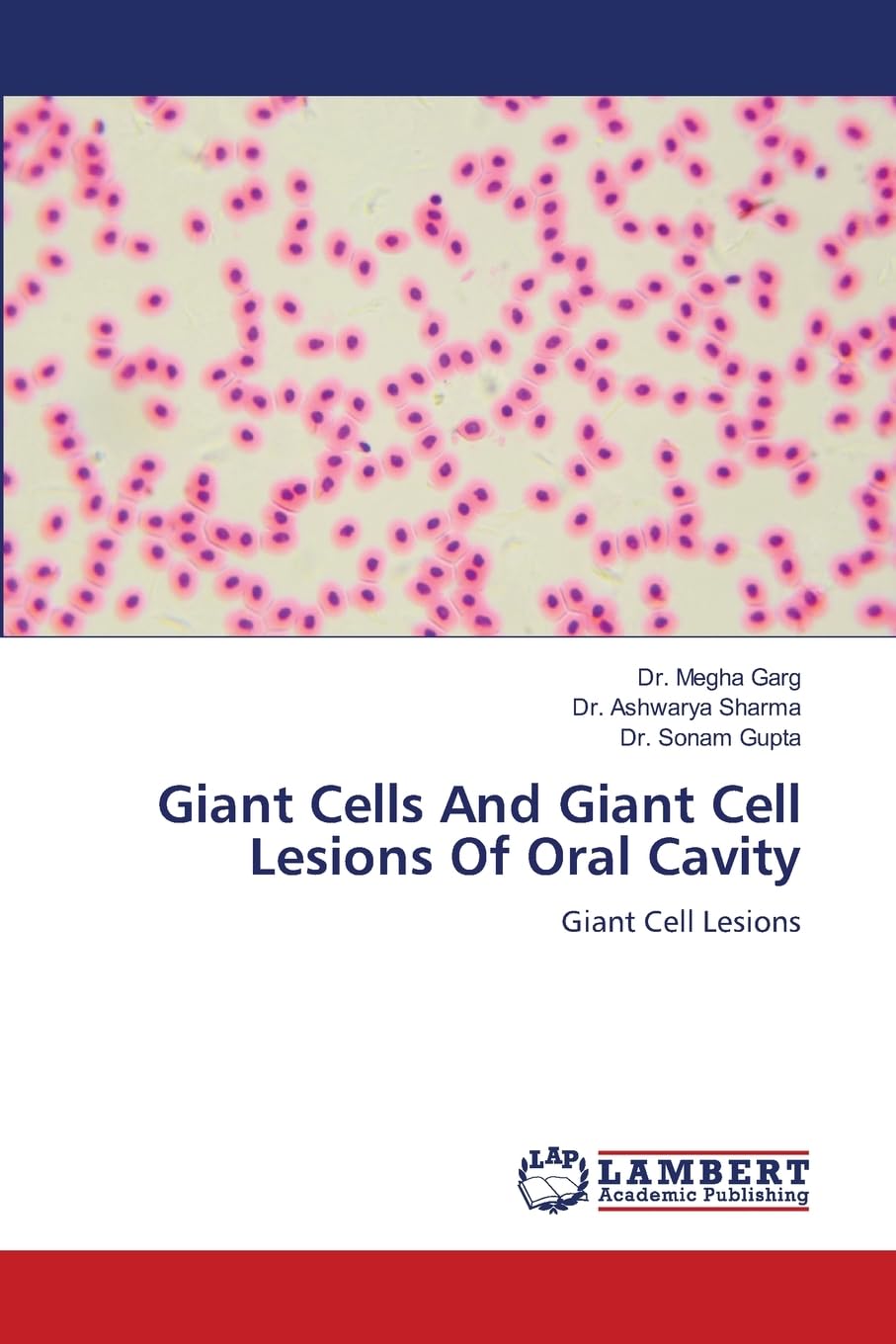 Giant Cells And Giant Cell Lesions Of Oral Cavity Medicine
