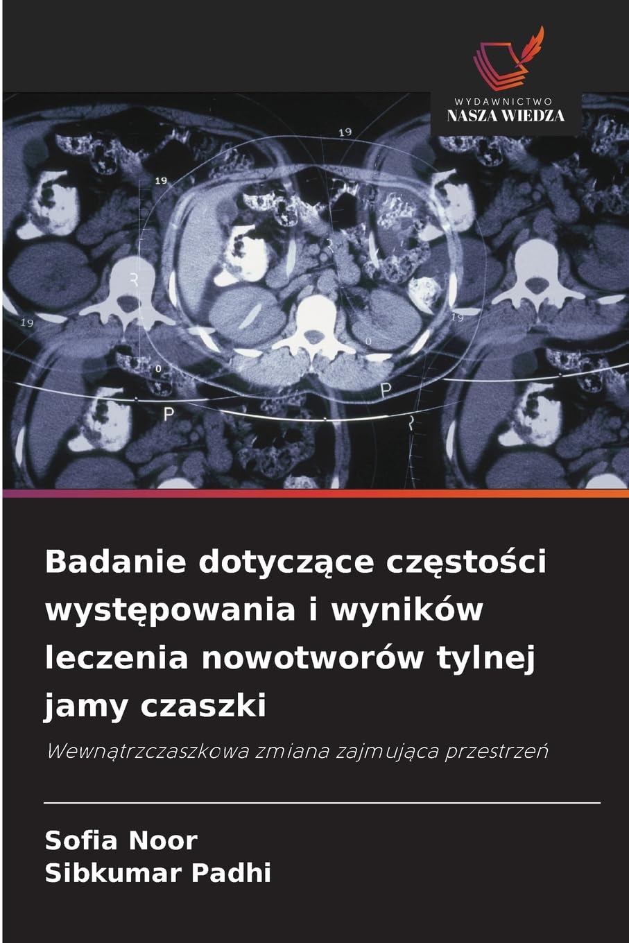 Badanie dotycz¿ce cz¿sto¿ci wyst¿powania i wyników leczenia nowotworów tylnej jamy czaszki Medicine