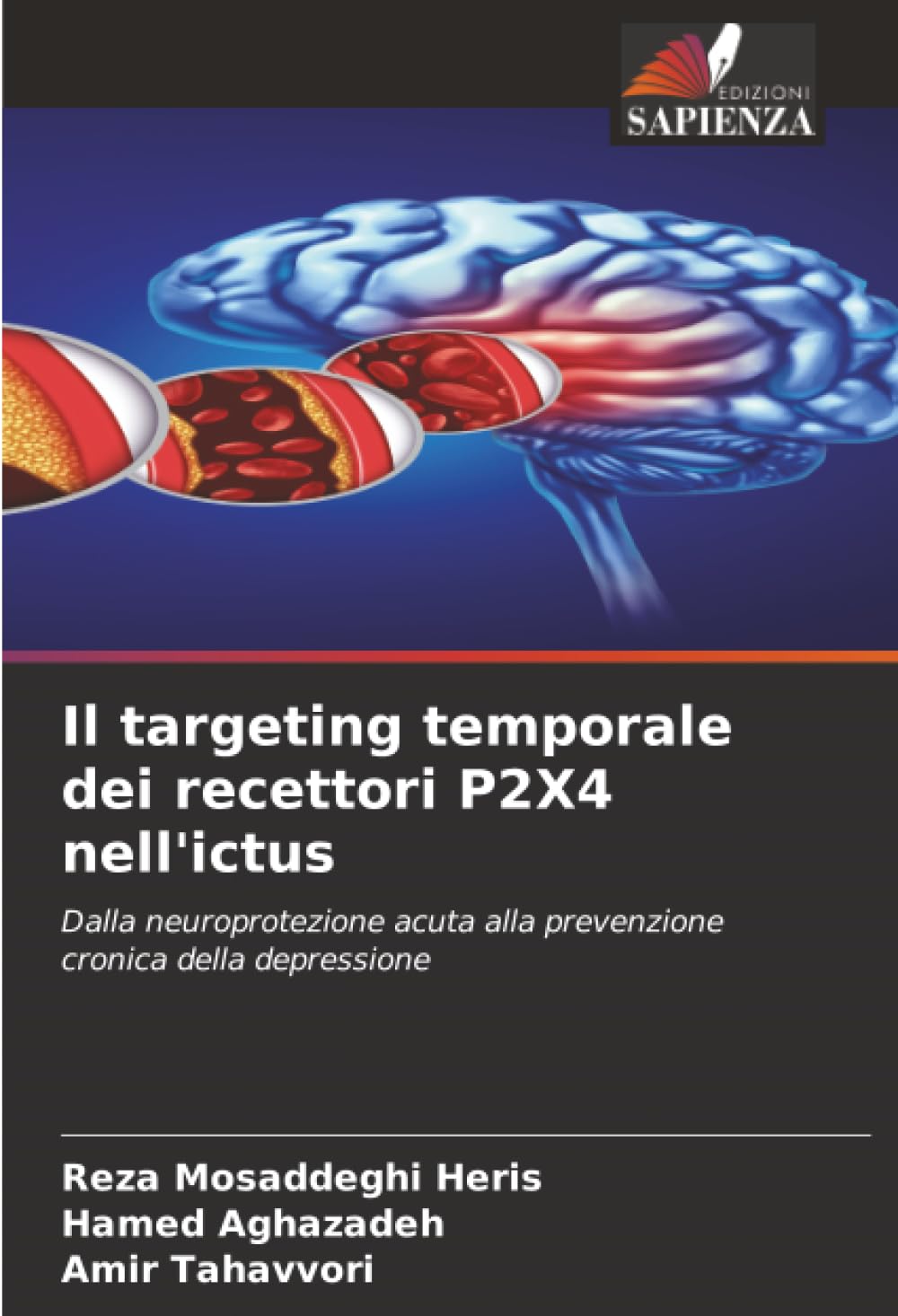 Il targeting temporale dei recettori P2X4 nell'ictus Medicine