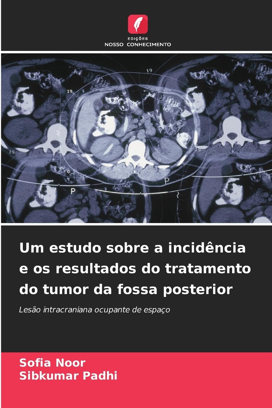 Um estudo sobre a incidência e os resultados do tratamento do tumor da fossa posterior Medicine