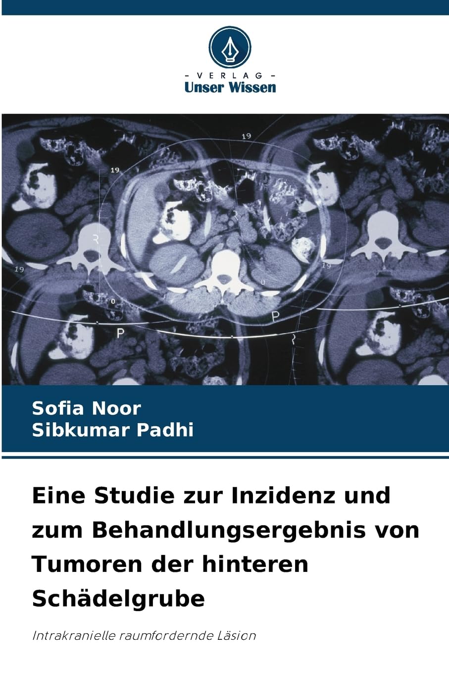 Eine Studie zur Inzidenz und zum Behandlungsergebnis von Tumoren der hinteren Schädelgrube Medicine