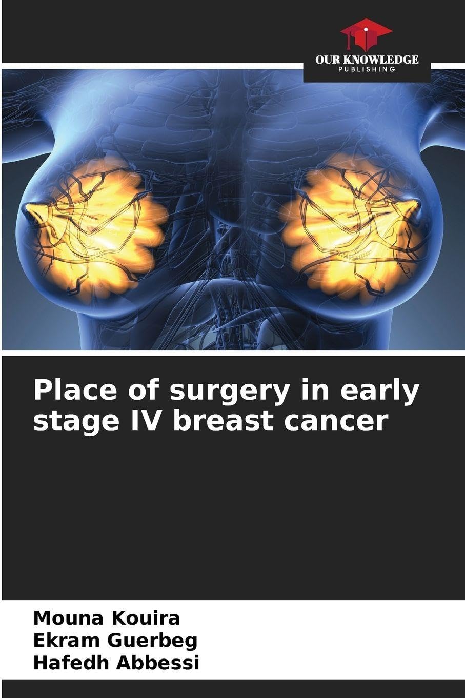 Place of surgery in early stage IV breast cancer Medicine