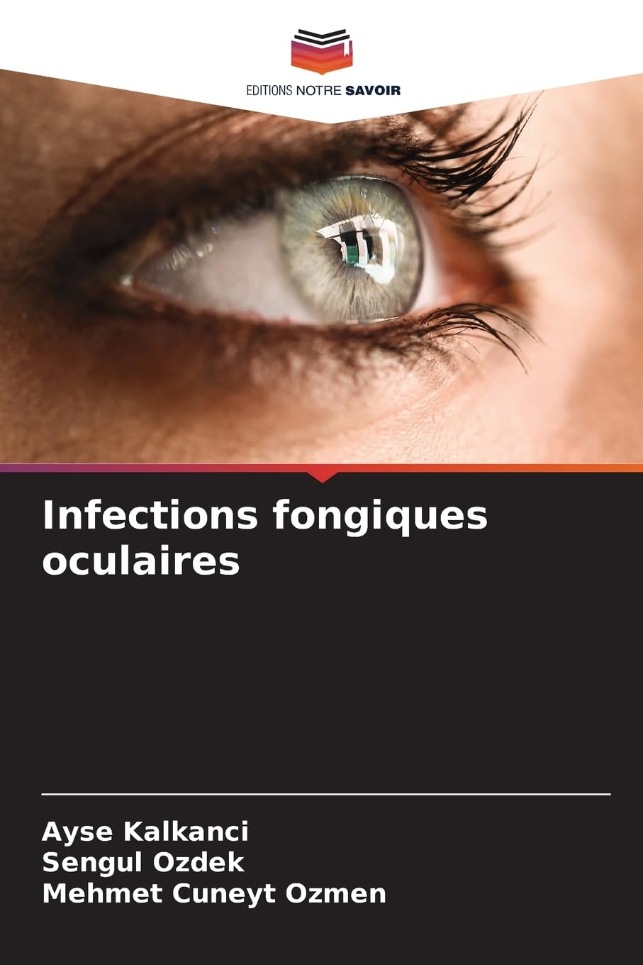 Infections fongiques oculaires Medicine