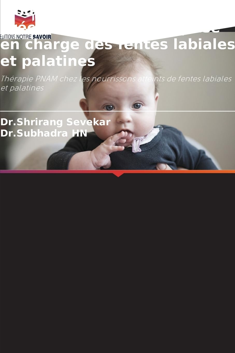Moulage nasoalvéolaire préchirurgical dans la prise en charge des fentes labiales et palatines Medicine