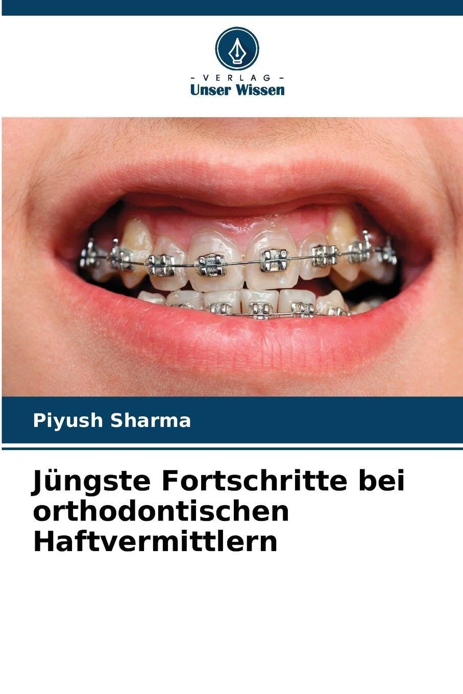 Jüngste Fortschritte bei orthodontischen Haftvermittlern Medicine