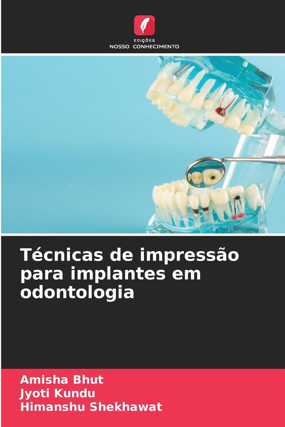 Técnicas de impressão para implantes em odontologia Medicine