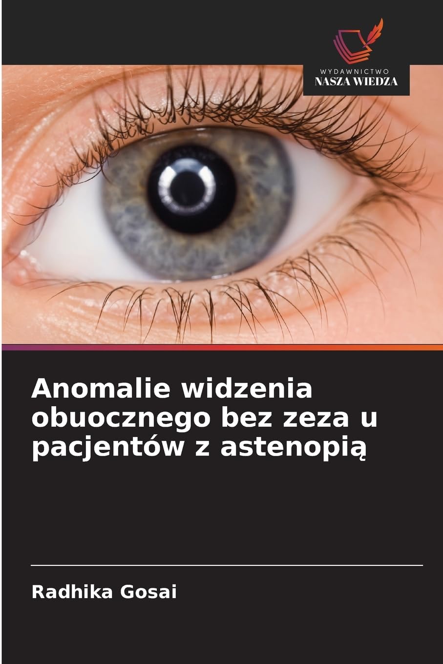 Anomalie widzenia obuocznego bez zeza u pacjentów z astenopi¿ Medicine
