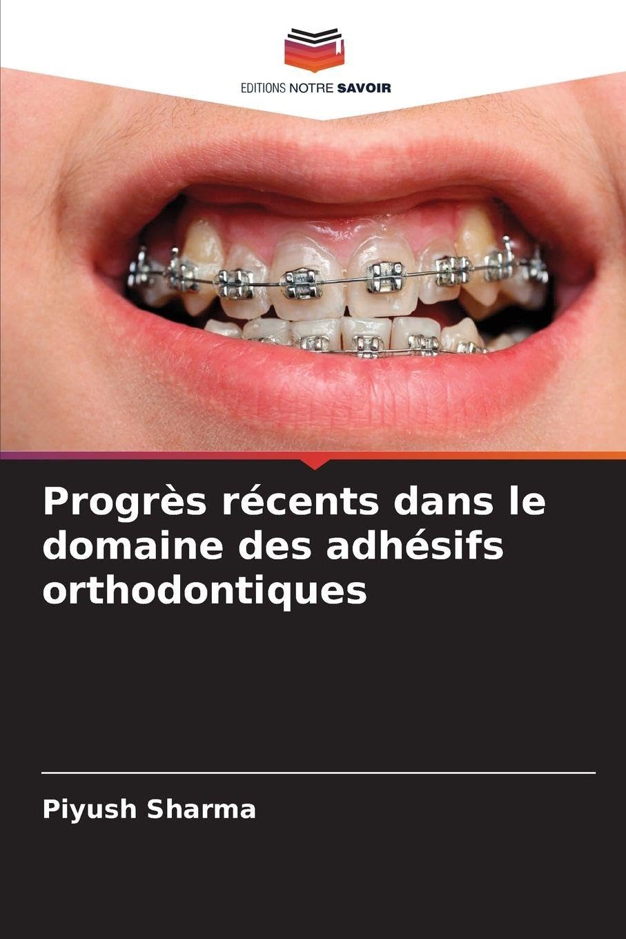 Progrès récents dans le domaine des adhésifs orthodontiques Medicine