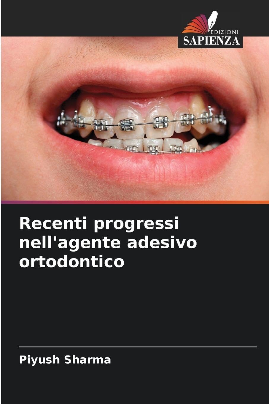 Recenti progressi nell'agente adesivo ortodontico Medicine