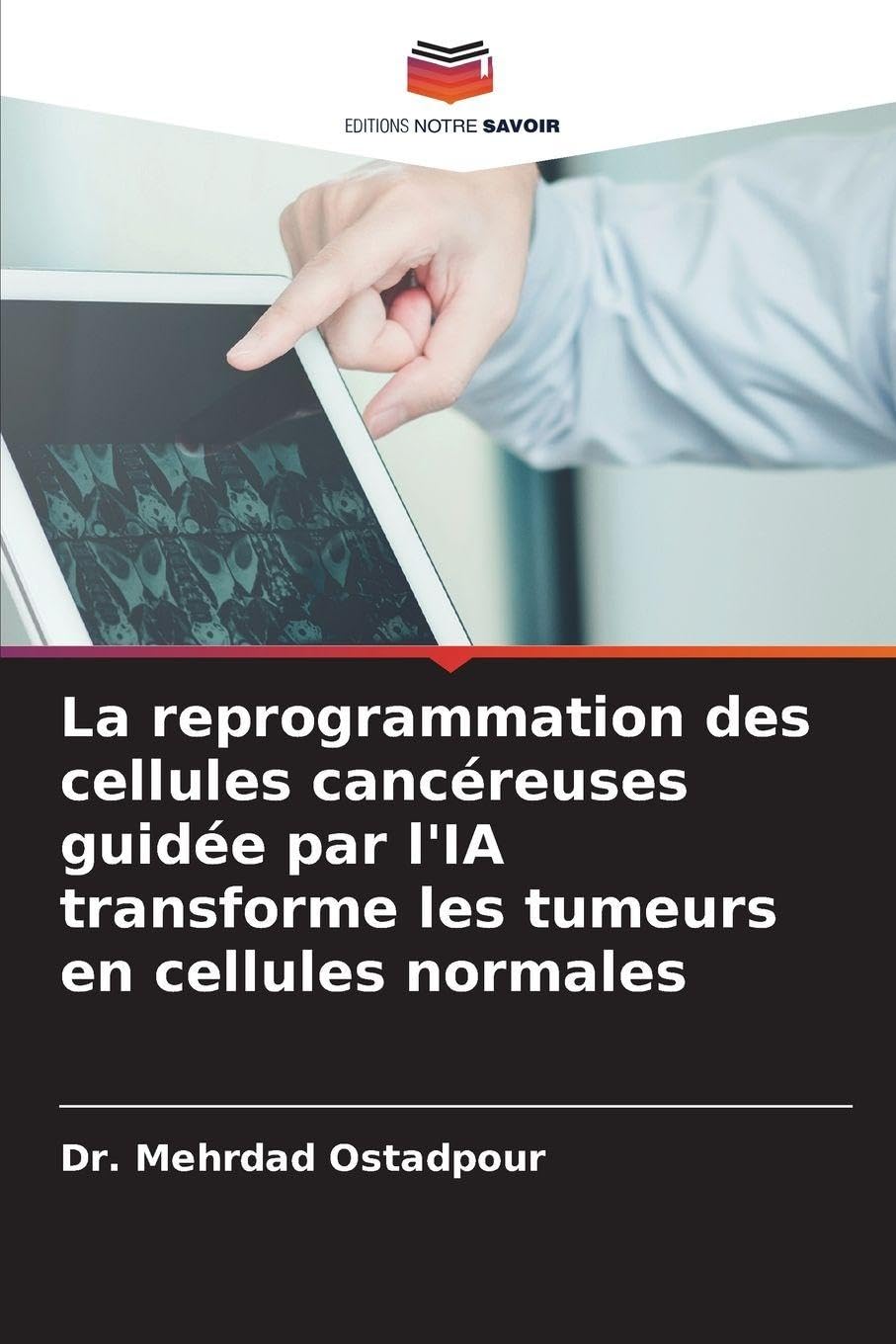 La reprogrammation des cellules cancéreuses guidée par l'IA transforme les tumeurs en cellules normales Medicine
