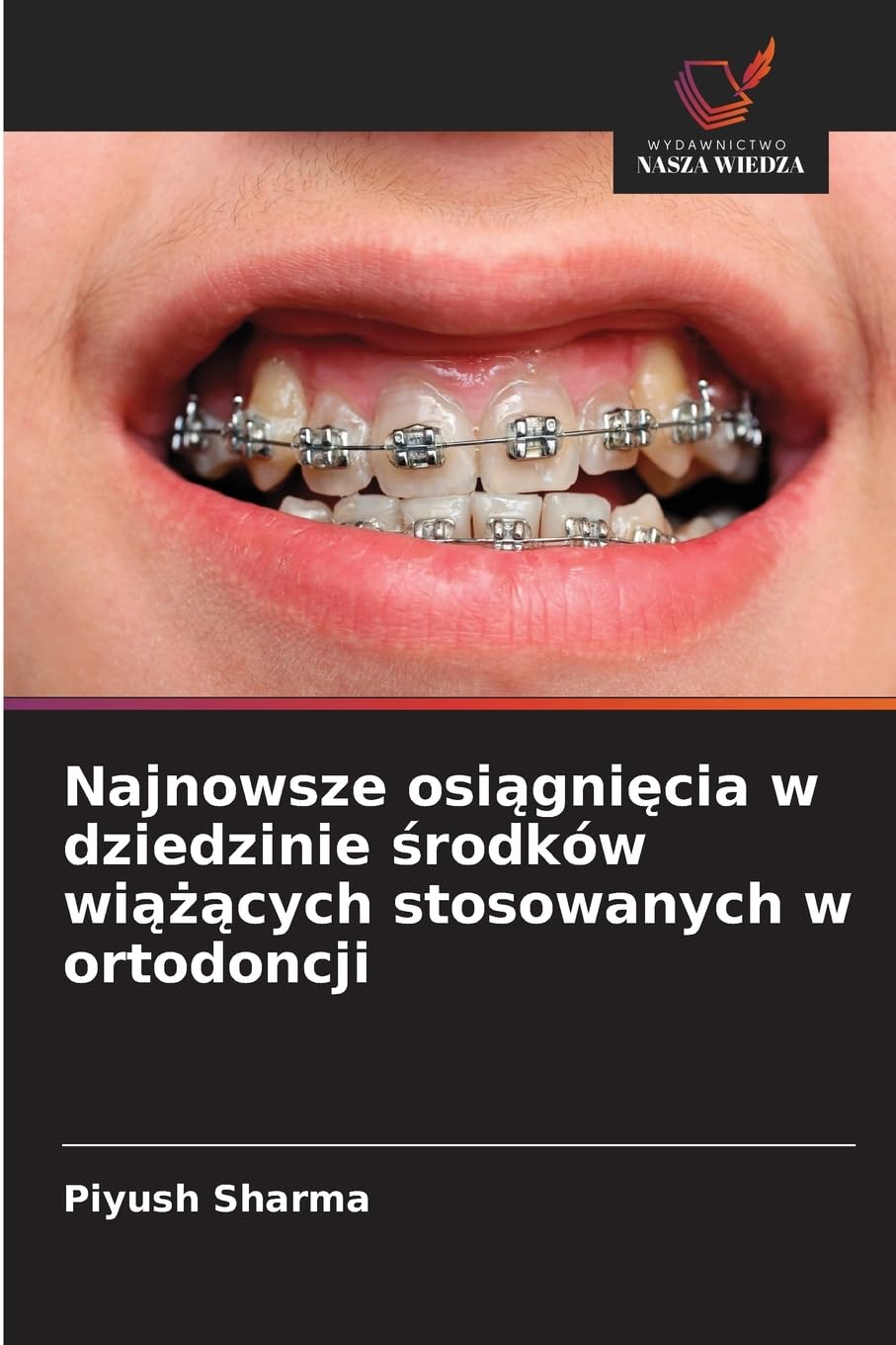 Najnowsze osi¿gni¿cia w dziedzinie ¿rodków wi¿¿¿cych stosowanych w ortodoncji Medicine