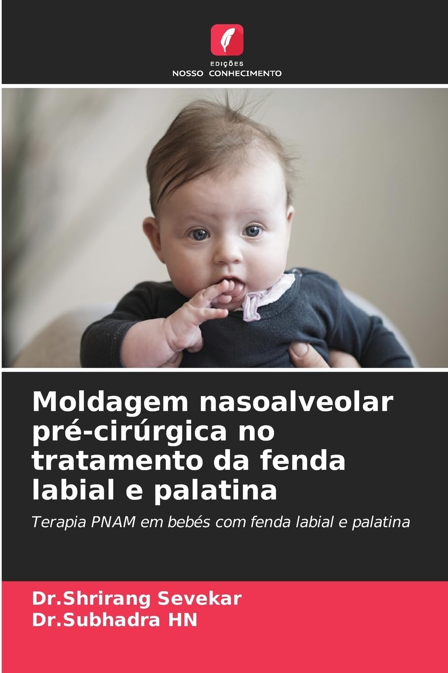 Moldagem nasoalveolar pré-cirúrgica no tratamento da fenda labial e palatina Medicine