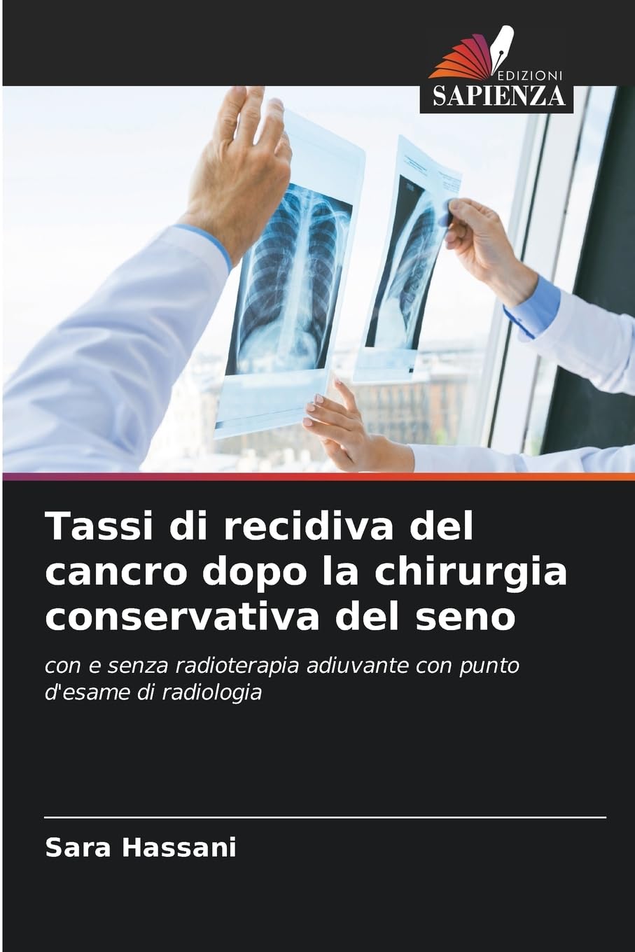 Tassi di recidiva del cancro dopo la chirurgia conservativa del seno Medicine