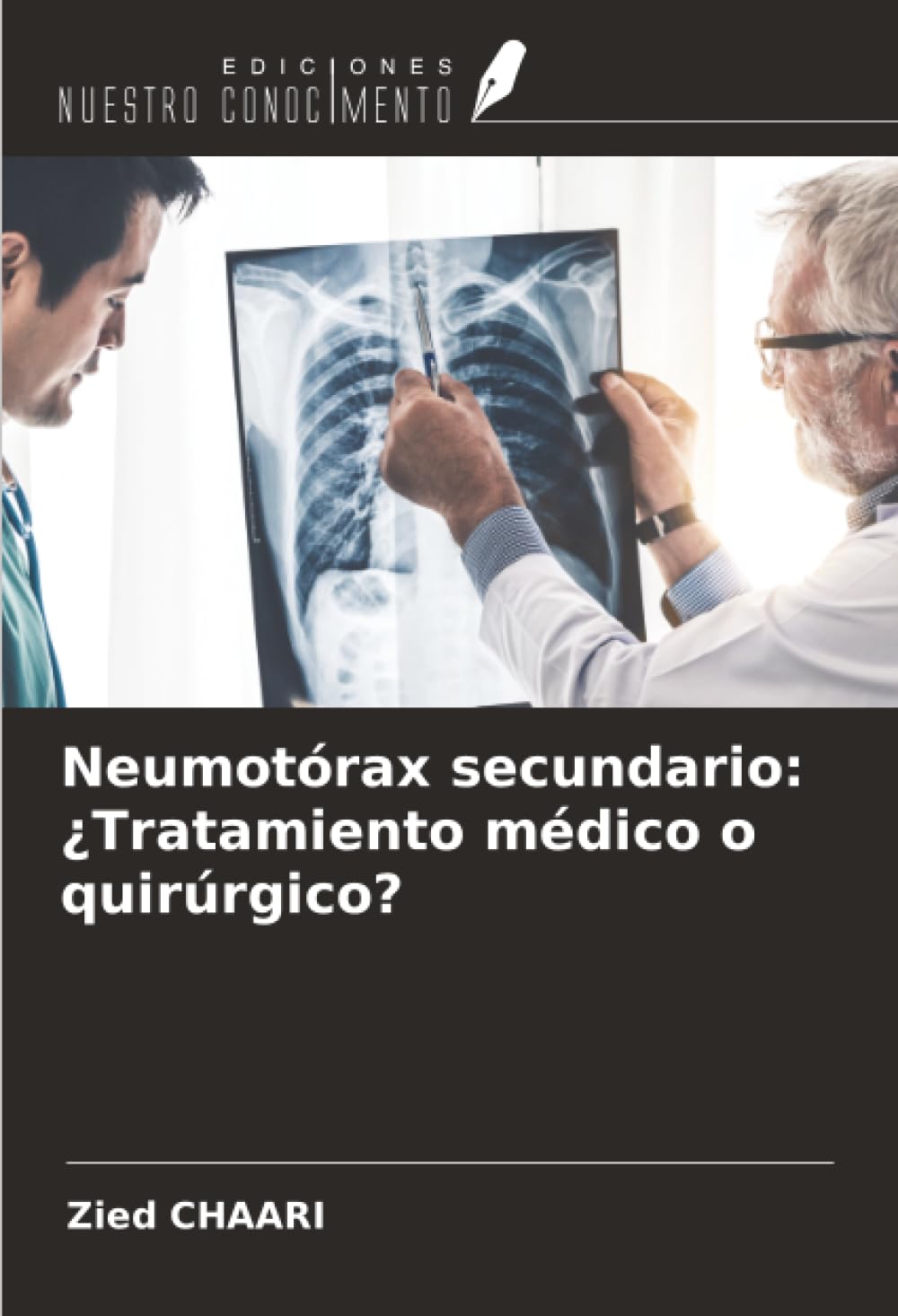 Neumotórax secundario: ¿Tratamiento médico o quirúrgico? Medicine