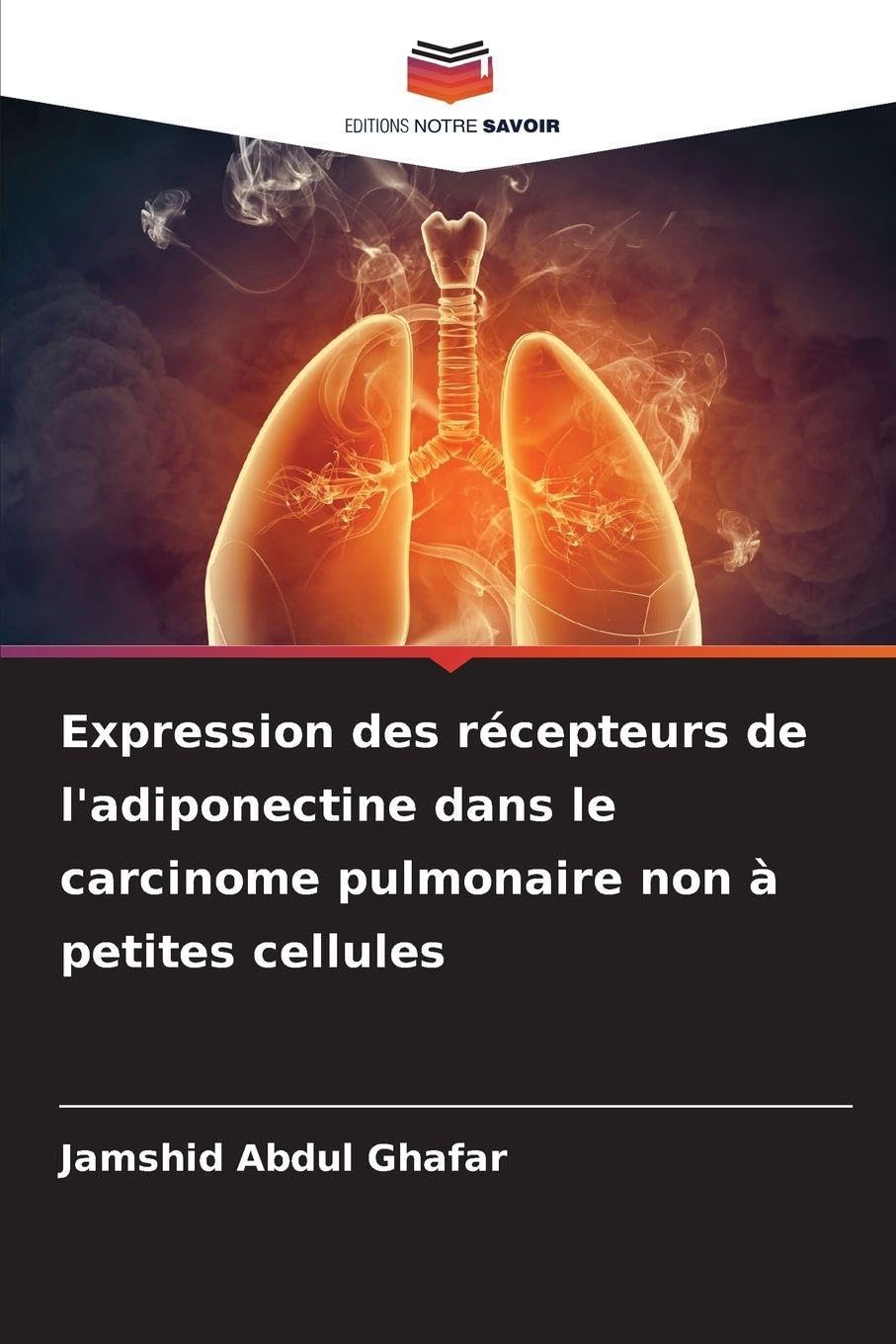 Expression des récepteurs de l'adiponectine dans le carcinome pulmonaire non à petites cellules Medicine
