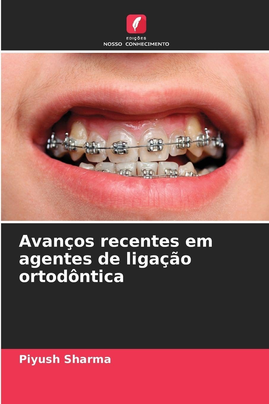 Avanços recentes em agentes de ligação ortodôntica Medicine