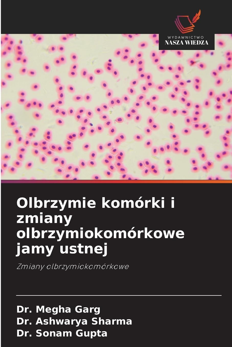 Olbrzymie komórki i zmiany olbrzymiokomórkowe jamy ustnej Medicine