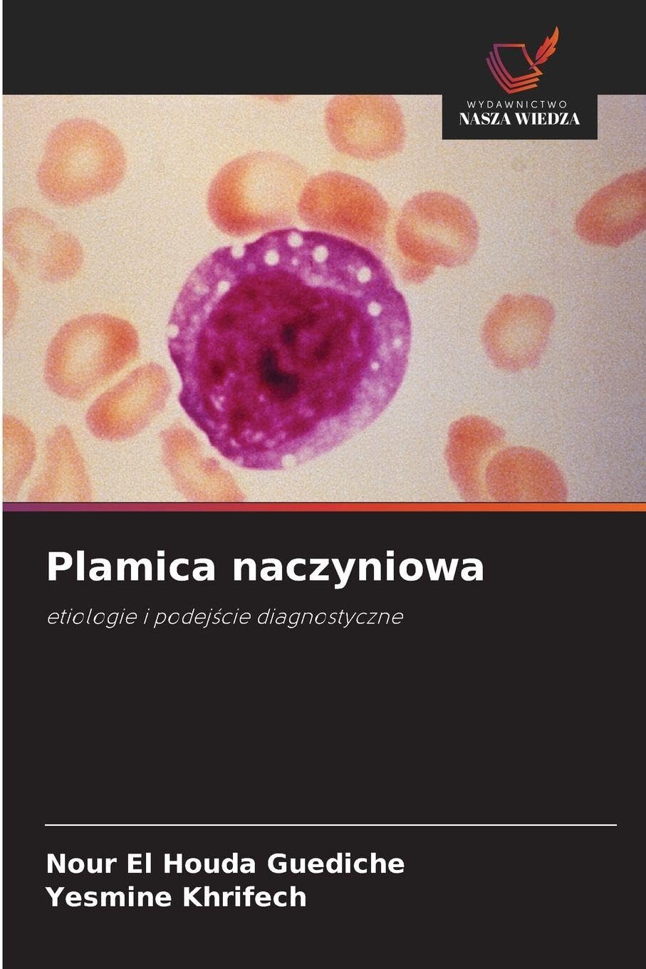 Plamica naczyniowa Medicine