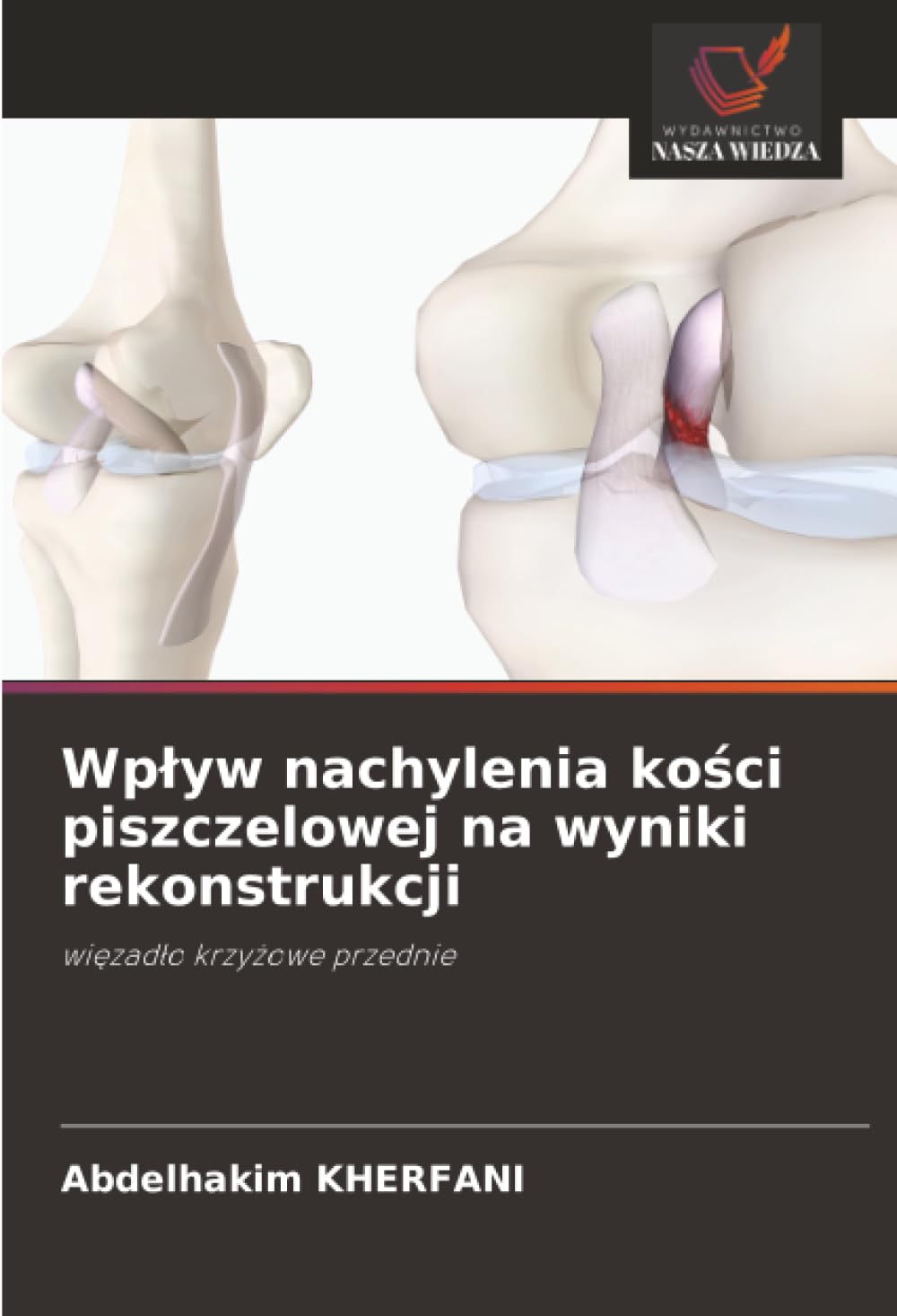 Wp¿yw nachylenia ko¿ci piszczelowej na wyniki rekonstrukcji Medicine