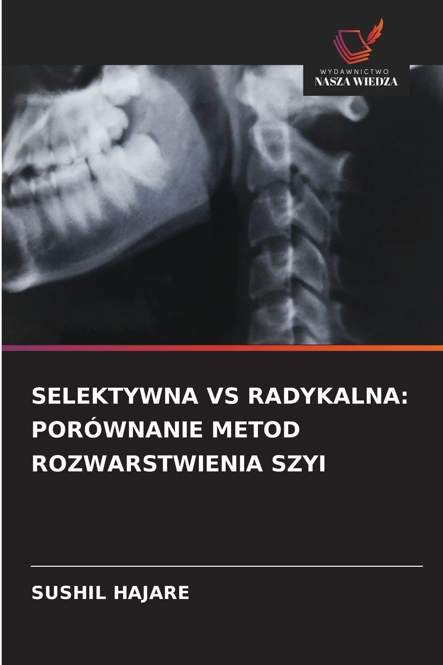 SELEKTYWNA VS RADYKALNA: PORÓWNANIE METOD ROZWARSTWIENIA SZYI Business, Finance & Career