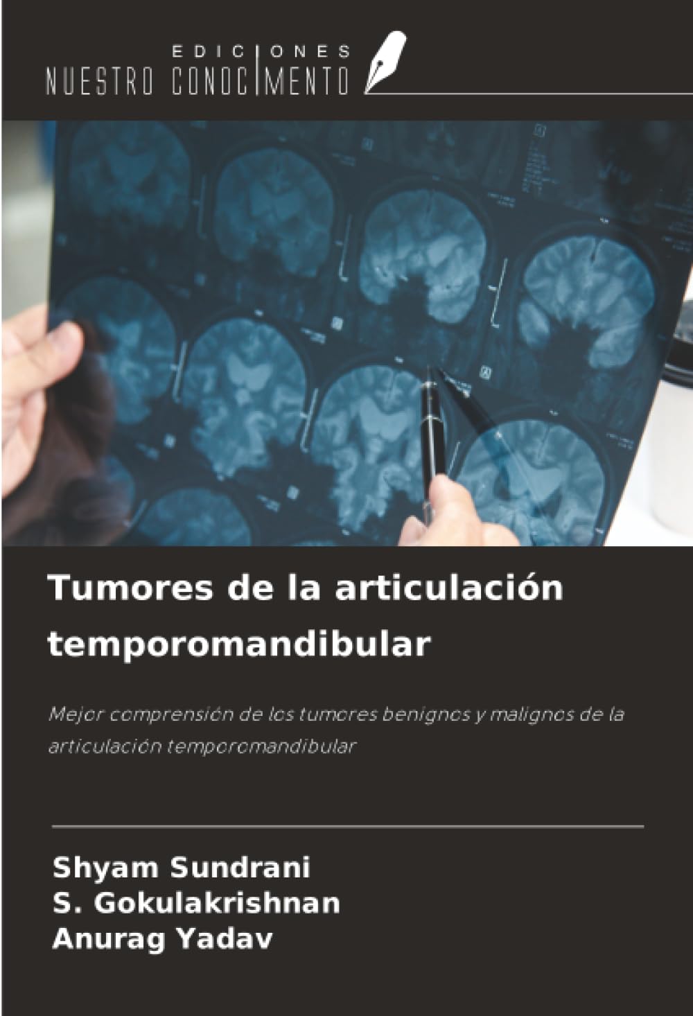 Tumores de la articulación temporomandibular Law