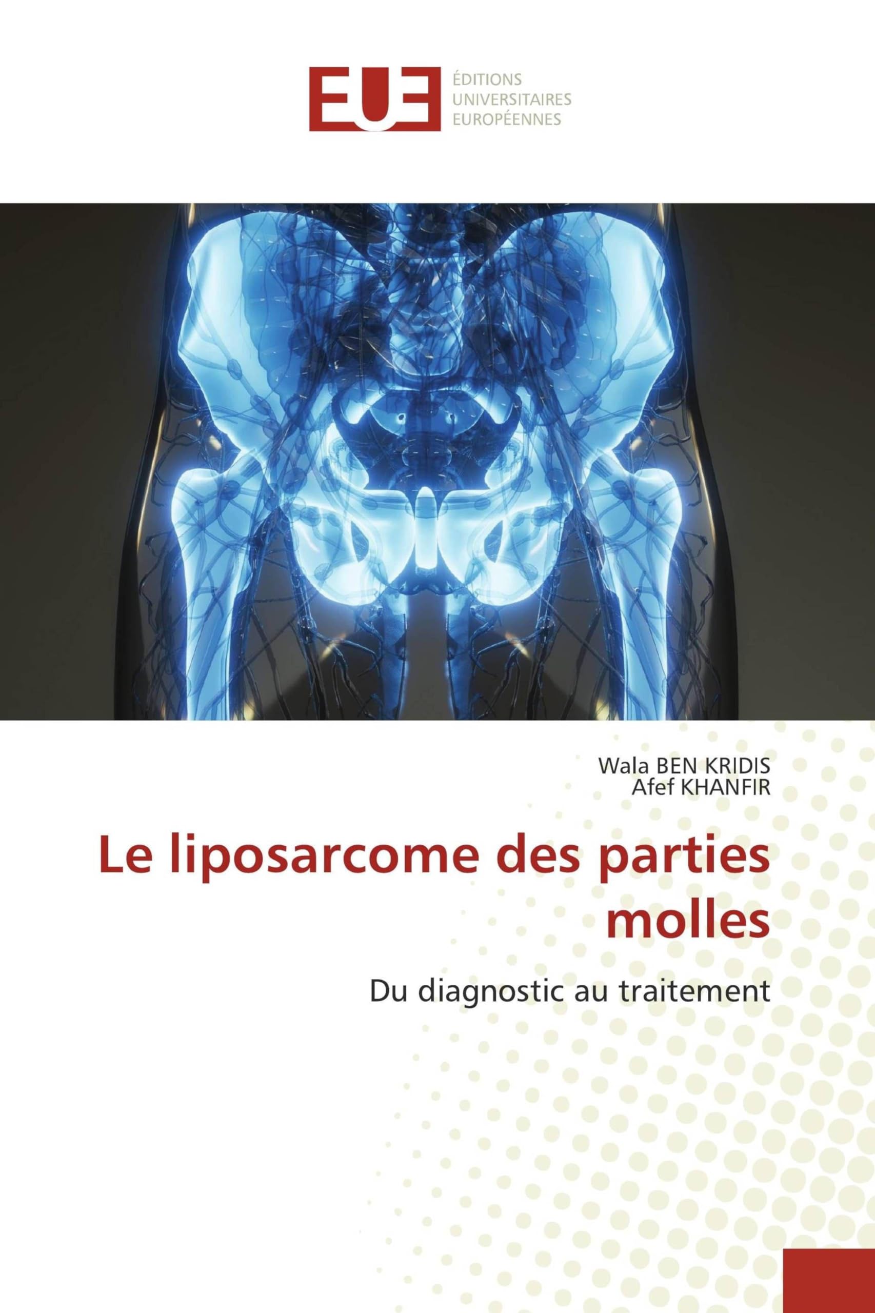 Le liposarcome des parties molles: Du diagnostic au traitement Books