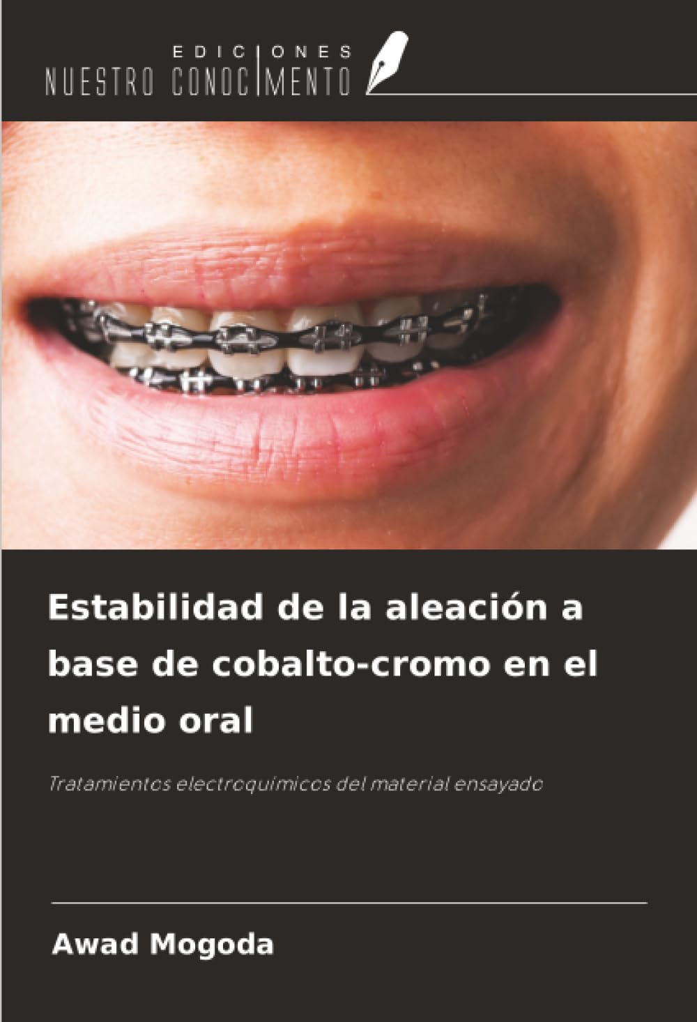 Estabilidad de la aleación a base de cobalto-cromo en el medio oral Natural Sciences