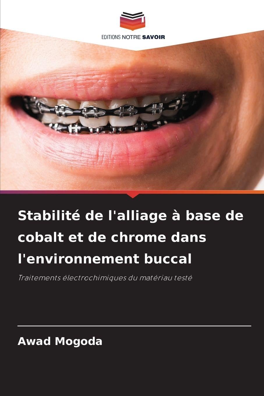 Stabilité de l'alliage à base de cobalt et de chrome dans l'environnement buccal Natural Sciences