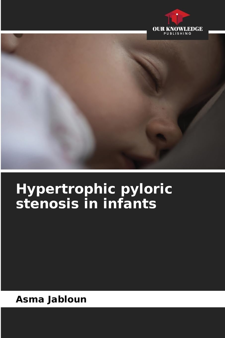 Hypertrophic pyloric stenosis in infants Medicine