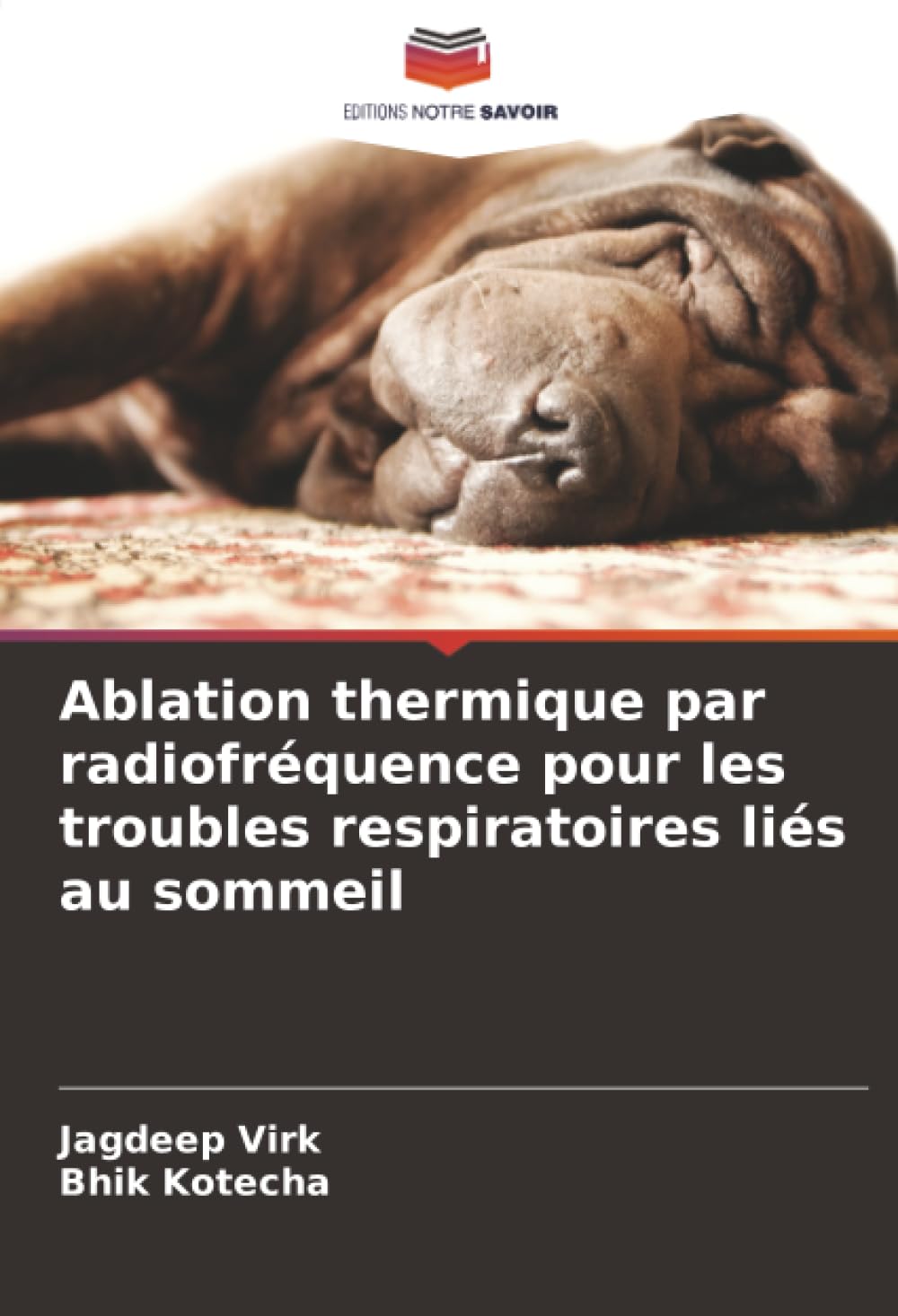 Ablation thermique par radiofréquence pour les troubles respiratoires liés au sommeil Medicine
