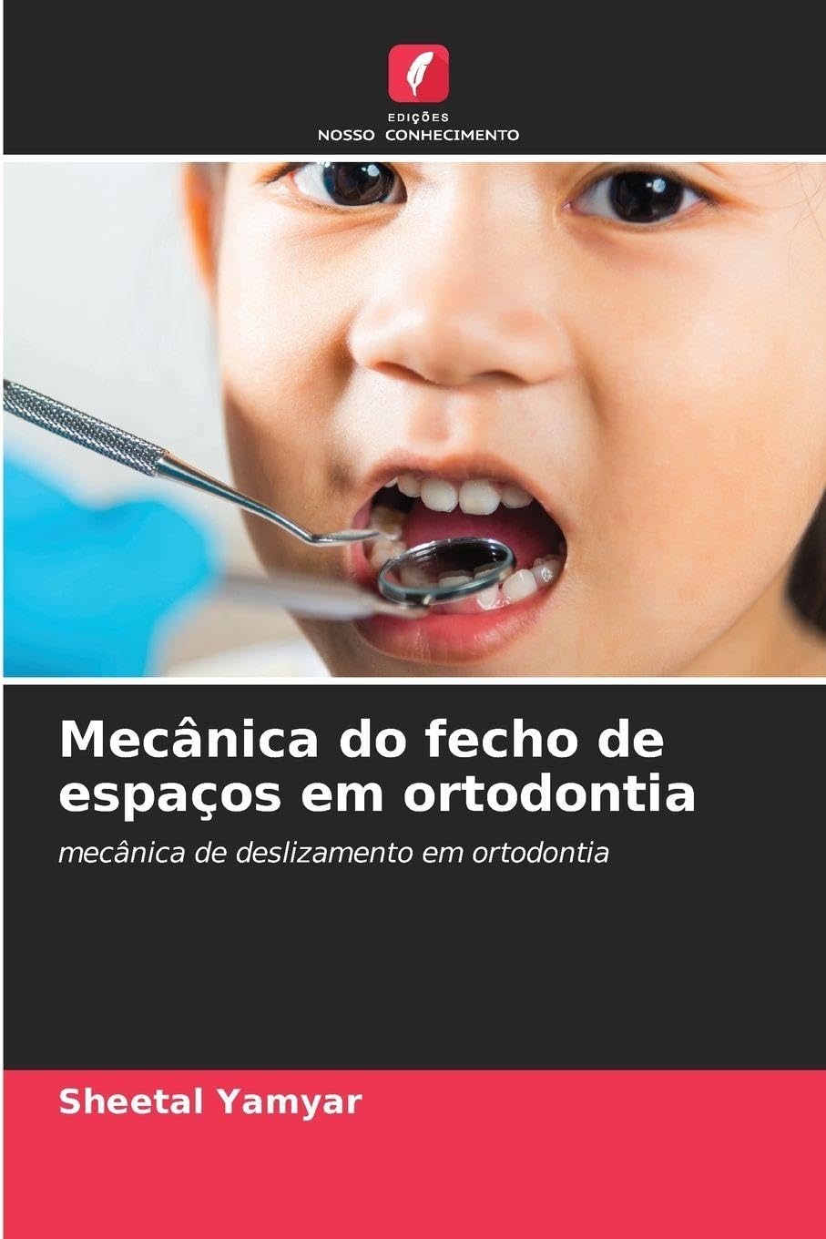 Mecânica do fecho de espaços em ortodontia Medicine