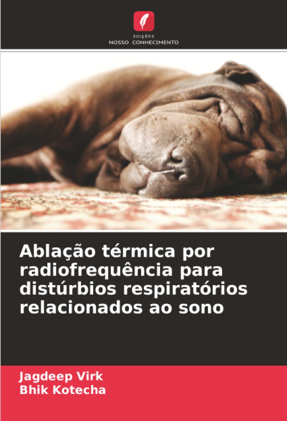 Ablação térmica por radiofrequência para distúrbios respiratórios relacionados ao sono Books