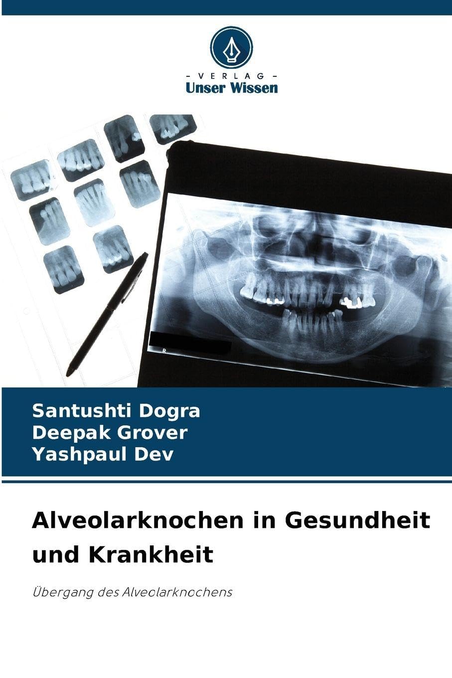 Alveolarknochen in Gesundheit und Krankheit Medicine