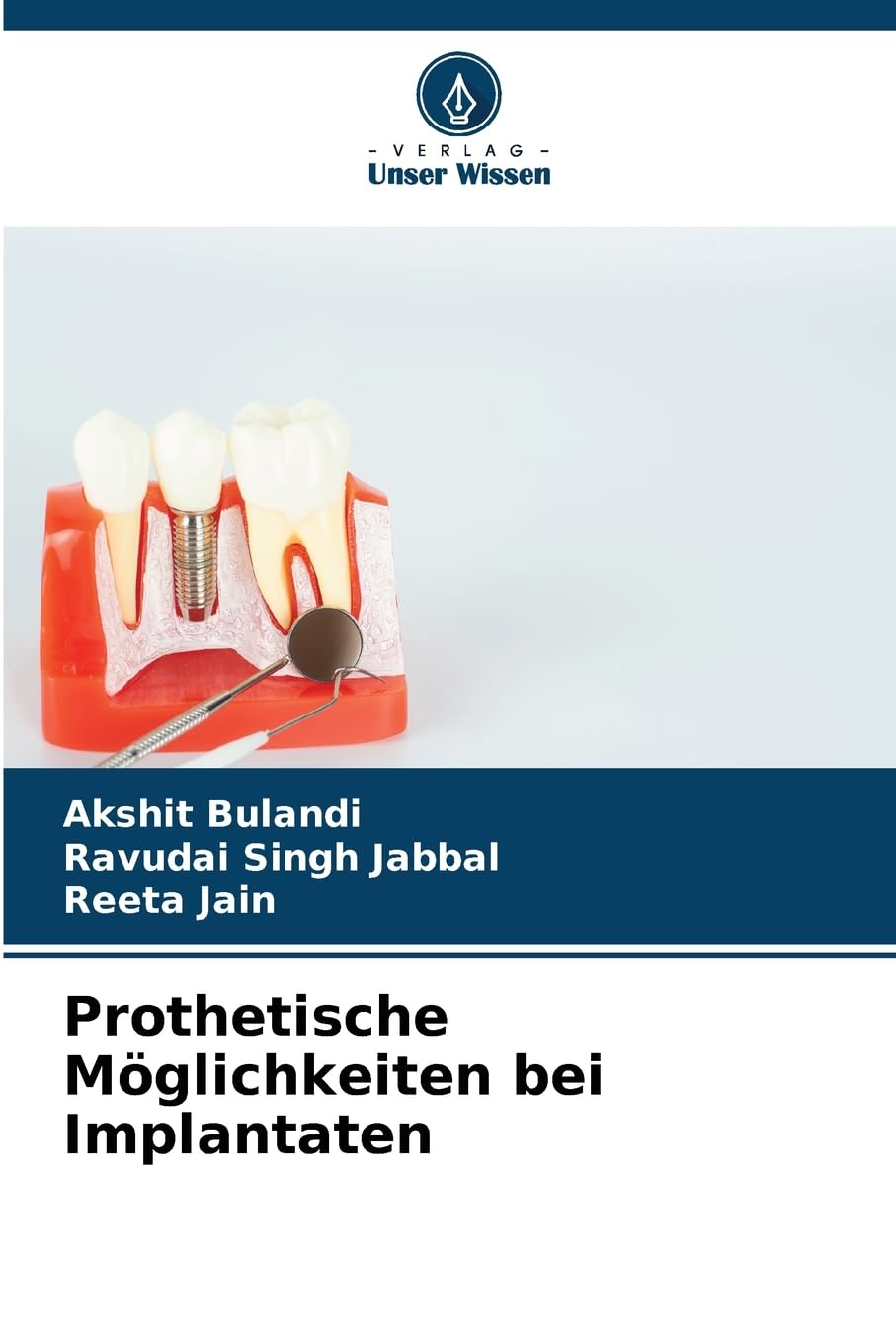 Prothetische Möglichkeiten bei Implantaten Law