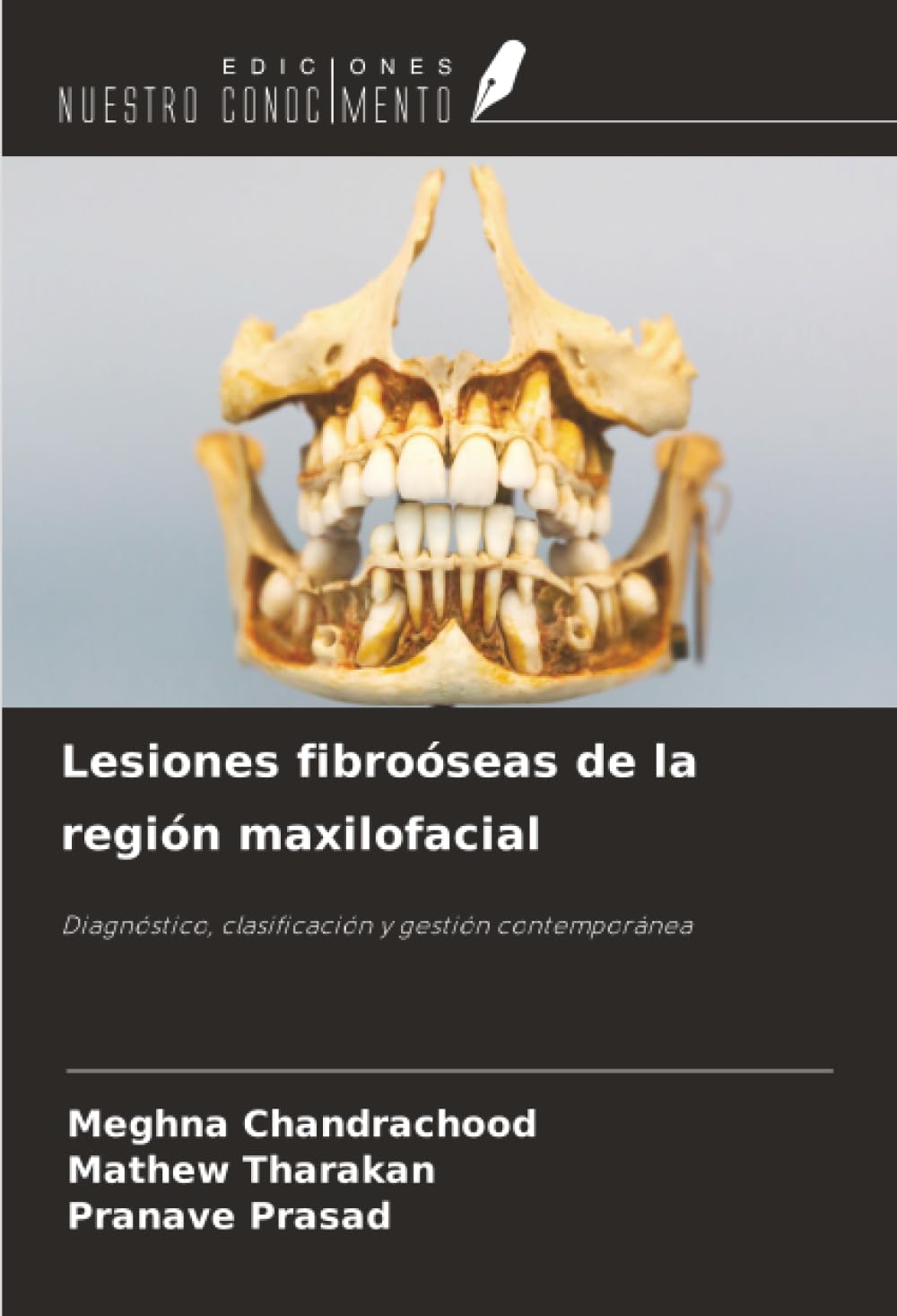 Lesiones fibroóseas de la región maxilofacial Medicine