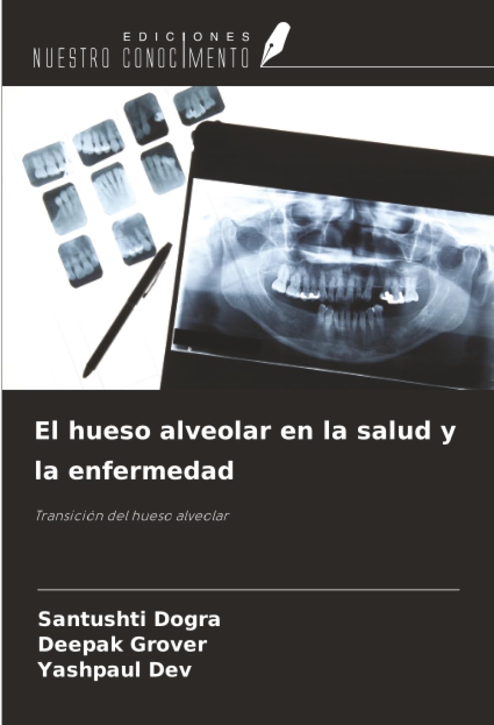 El hueso alveolar en la salud y la enfermedad Medicine
