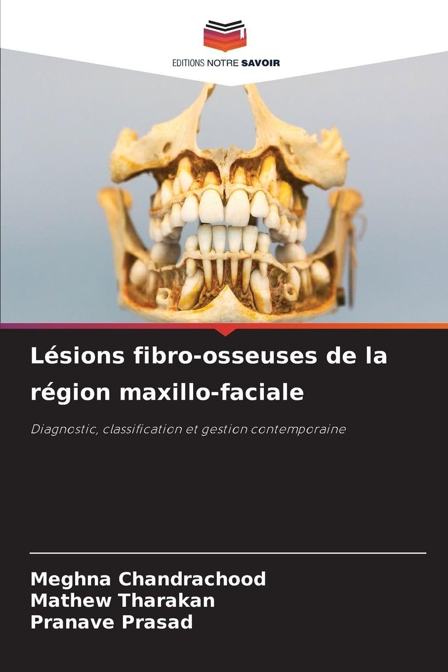 Lésions fibro-osseuses de la région maxillo-faciale Medicine