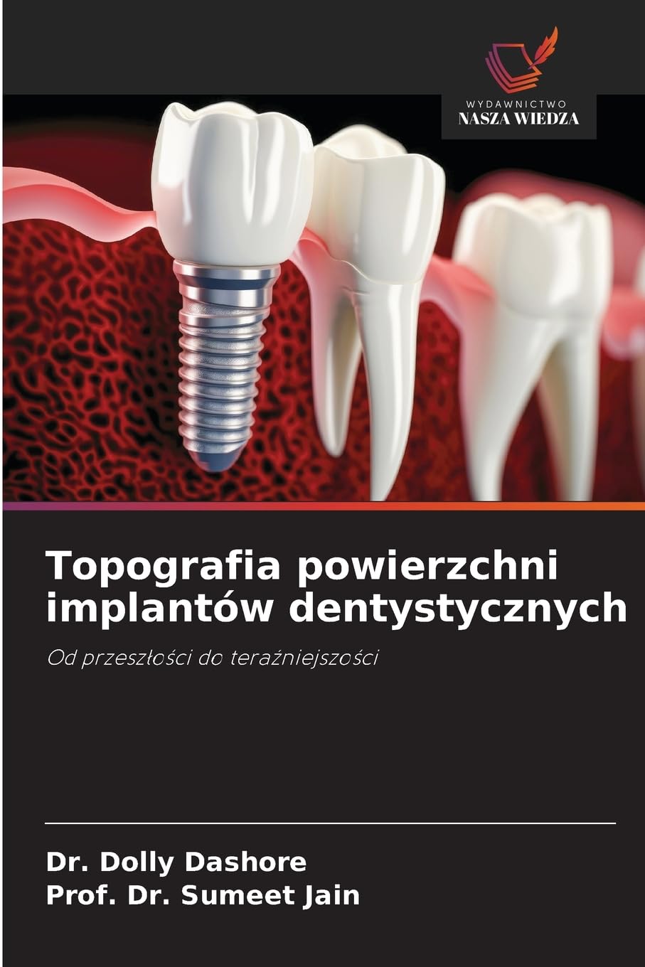 Topografia powierzchni implantów dentystycznych Books