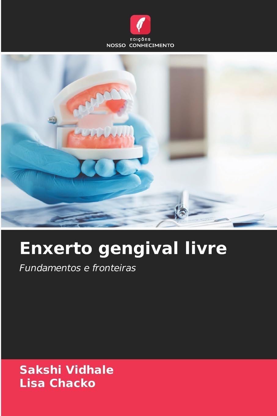 Enxerto gengival livre Medicine