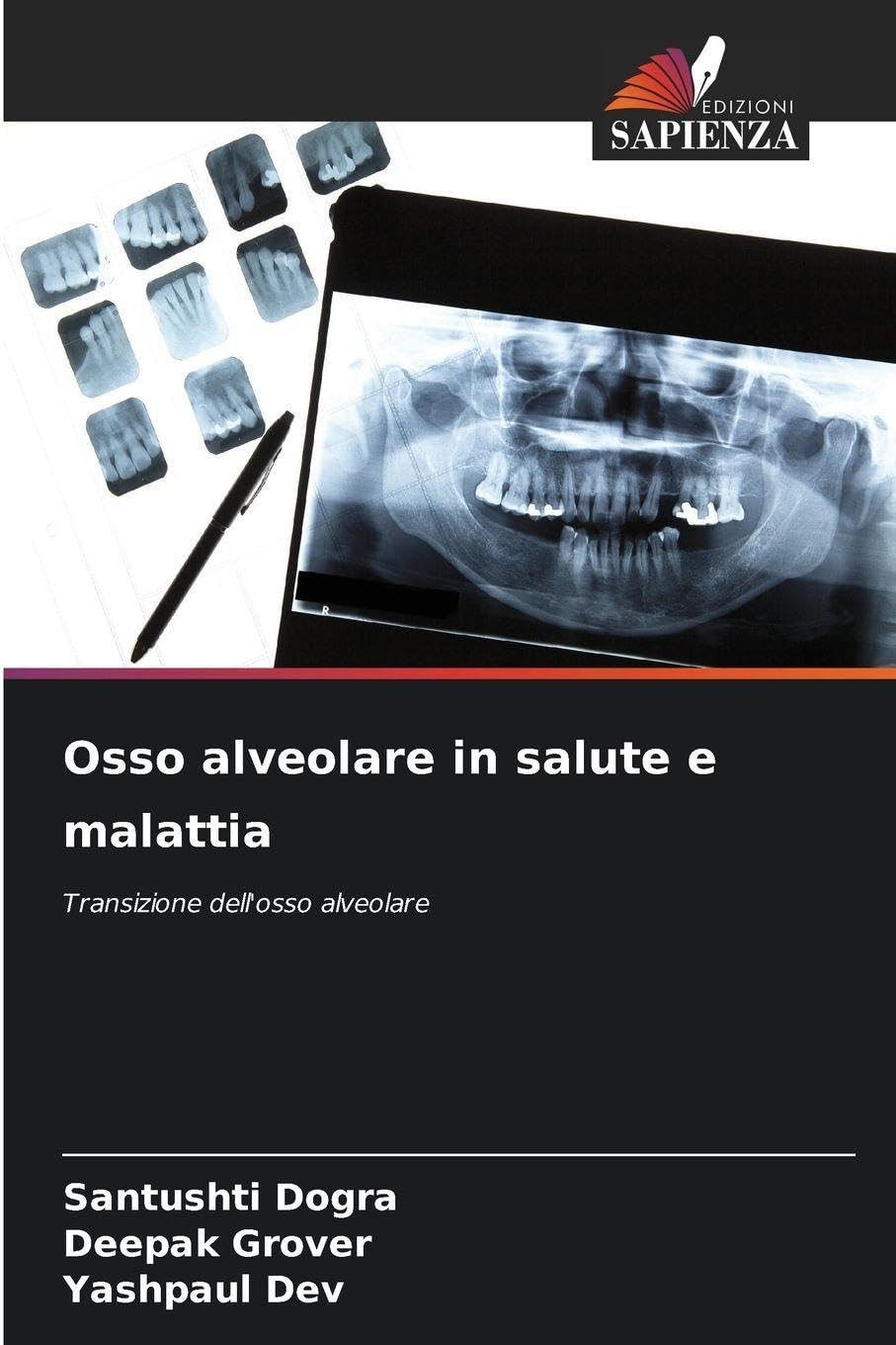 Osso alveolare in salute e malattia Medicine