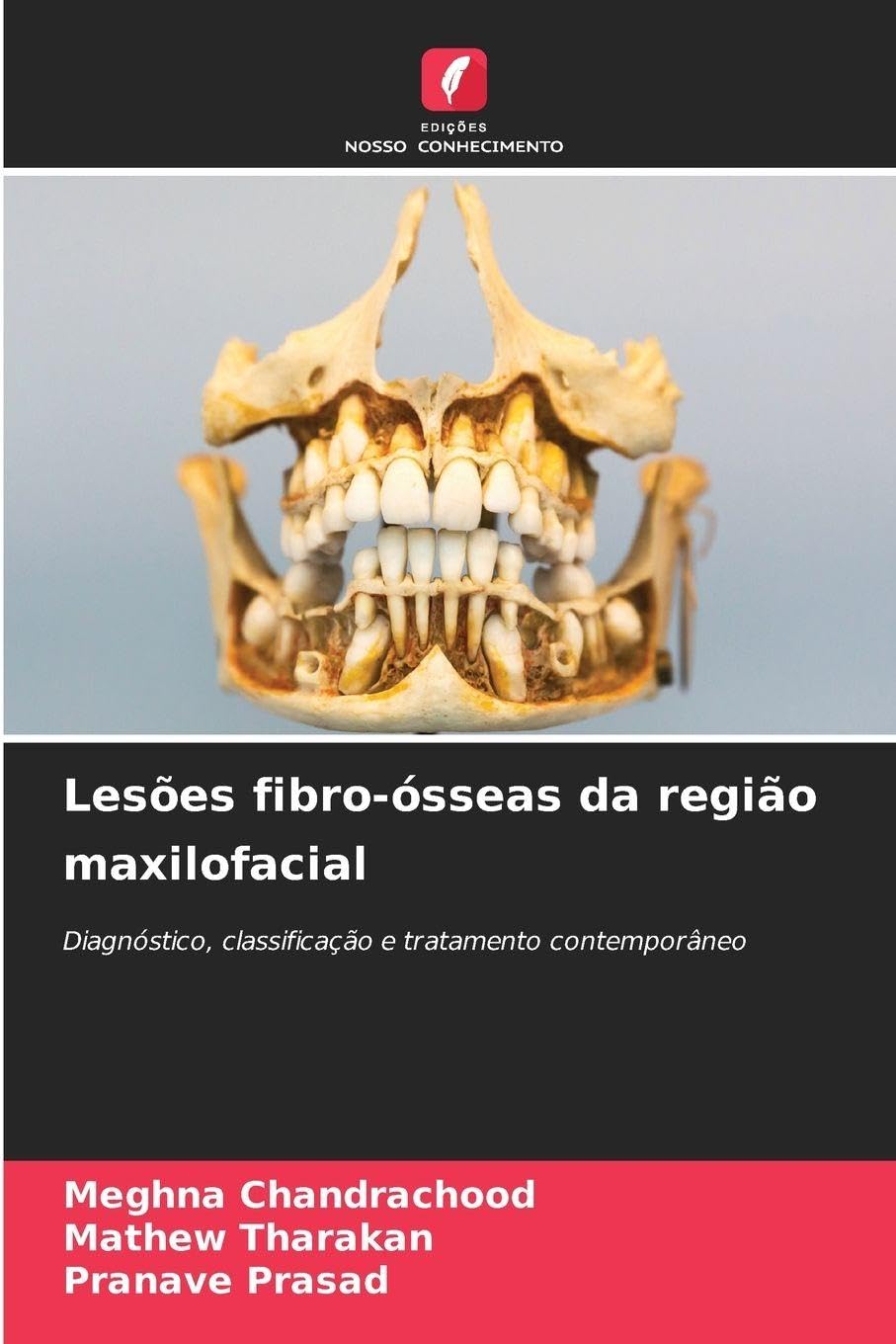 Lesões fibro-ósseas da região maxilofacial Medicine