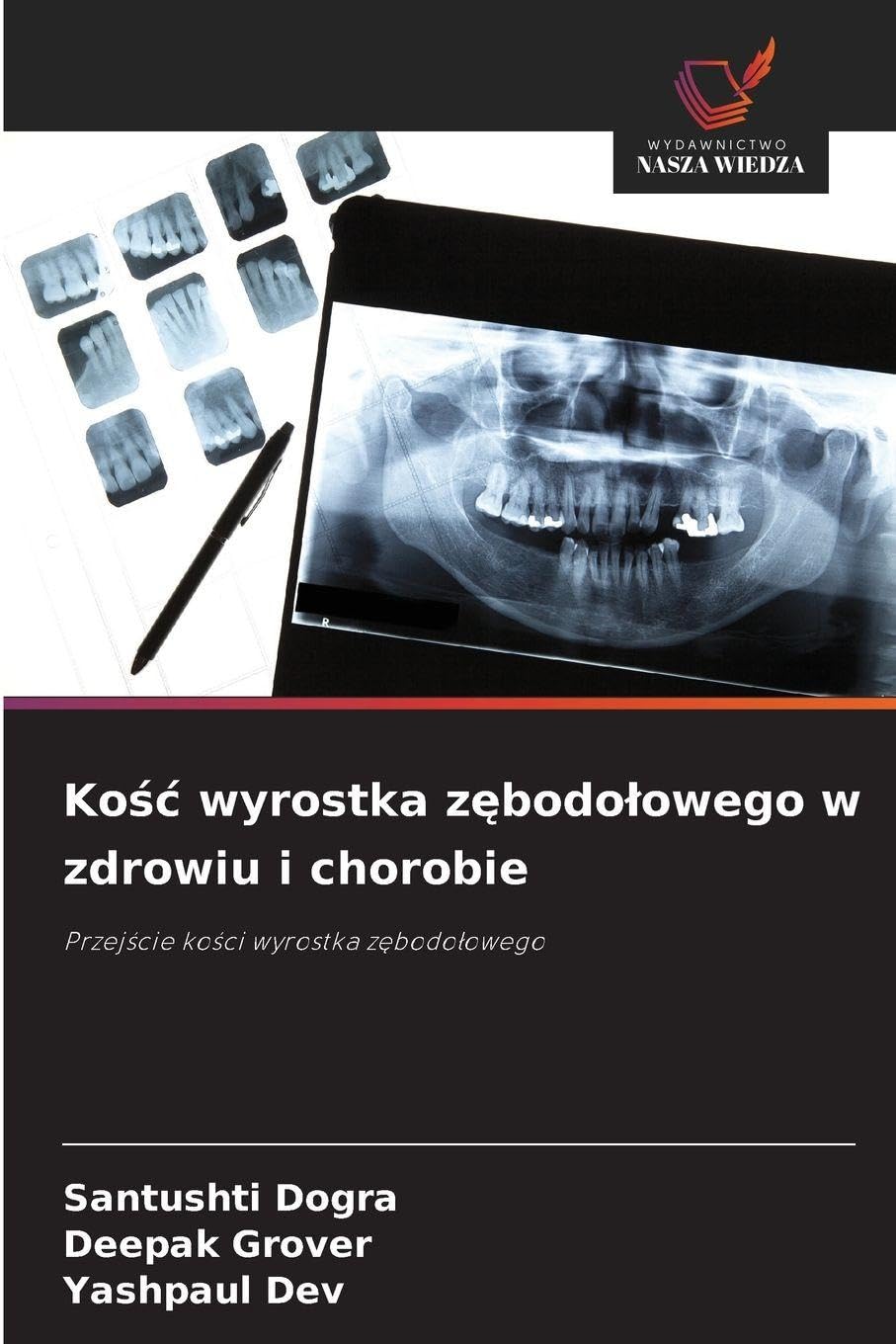 Ko¿¿ wyrostka z¿bodo¿owego w zdrowiu i chorobie Medicine