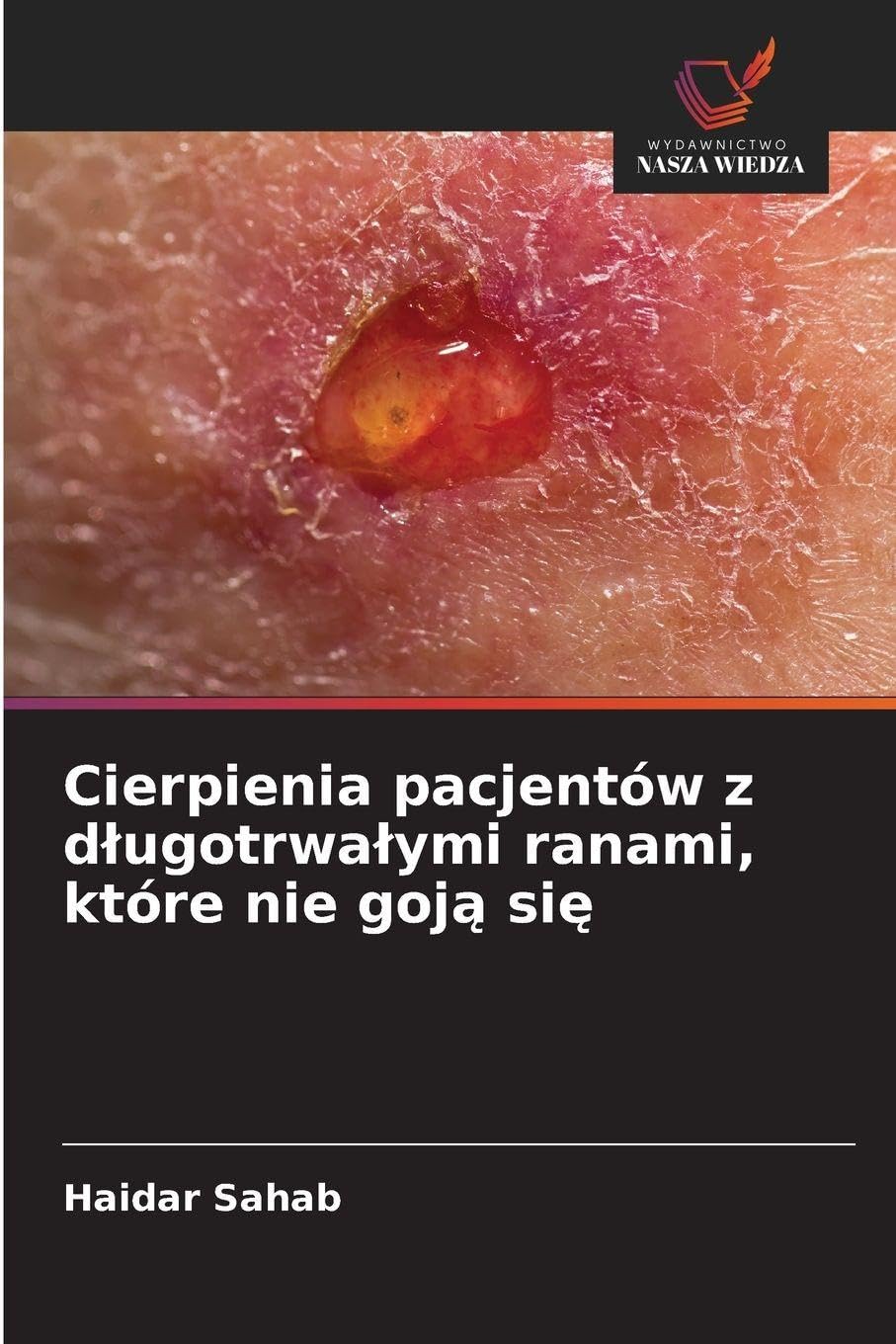 Cierpienia pacjentów z d¿ugotrwa¿ymi ranami, które nie goj¿ si¿ Medicine