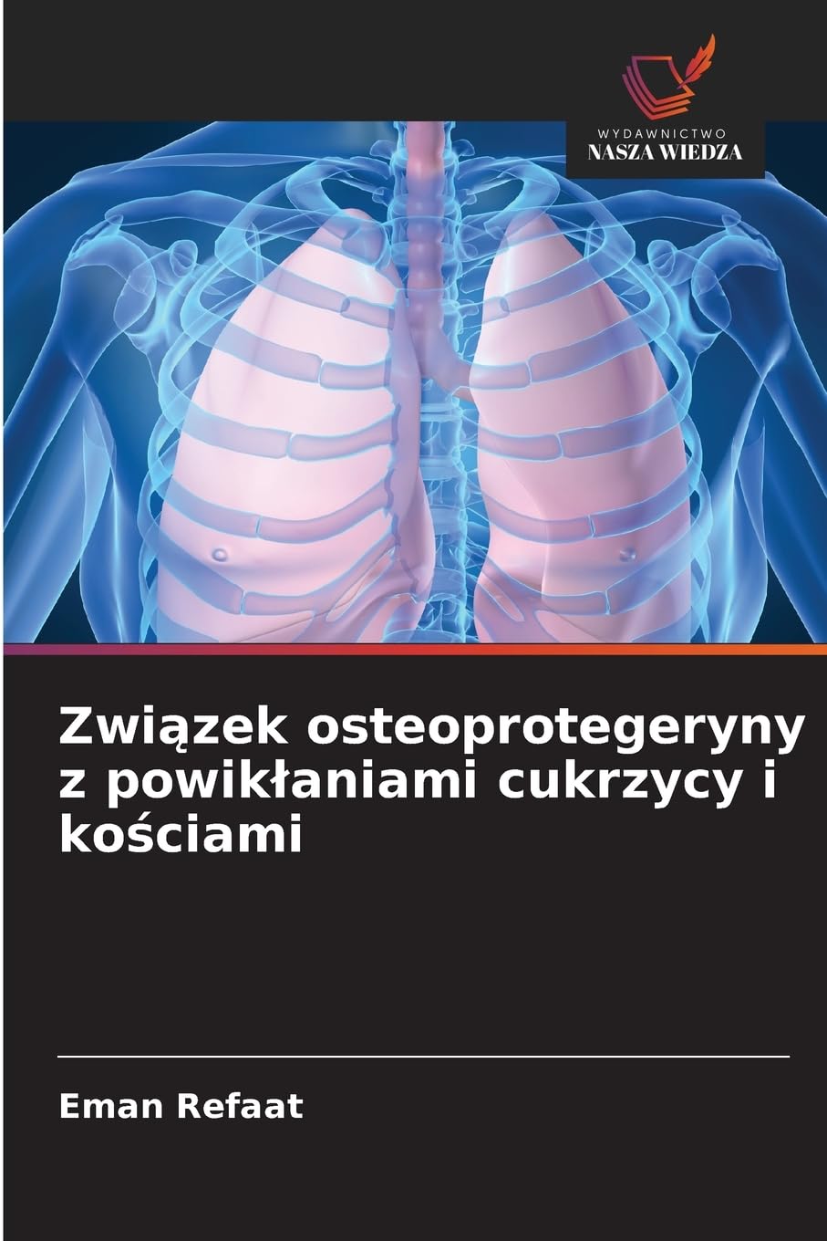 Zwi¿zek osteoprotegeryny z powik¿aniami cukrzycy i ko¿ciami Medicine